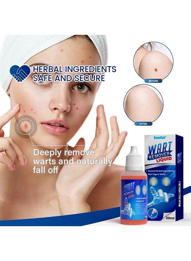 Sumifun Wart Remover, Maximum Strength Salicylic Acid Wart Liquid, One Step Invisible Wart Remover Strips, Fast-Acting Wart Liquid Freeze Off for Warts, Plantar Wart, Common Wart, Flat Wart 20ml - Image 5